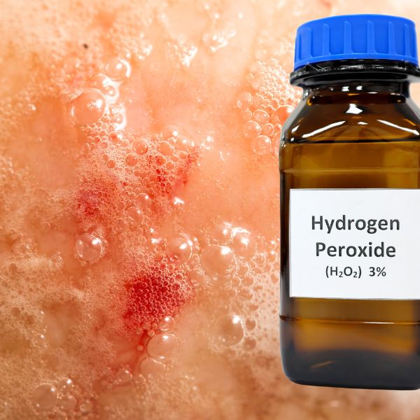 Hydrogen Peroxide & Blood Stains